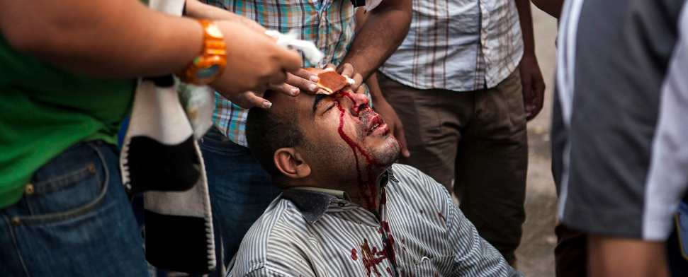 Ein verletzter Mursi-Anhänger wird am 6. Oktober nahe Kairo behandelt.